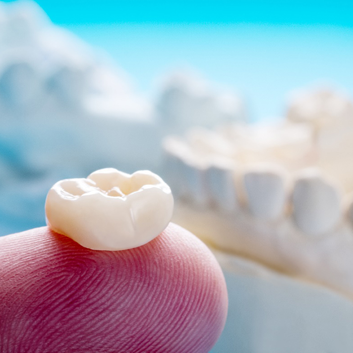 A close-up of a dental crown sitting on a person’s finger