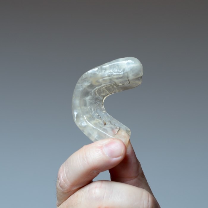 Hand holding a white nightguard for bruxism