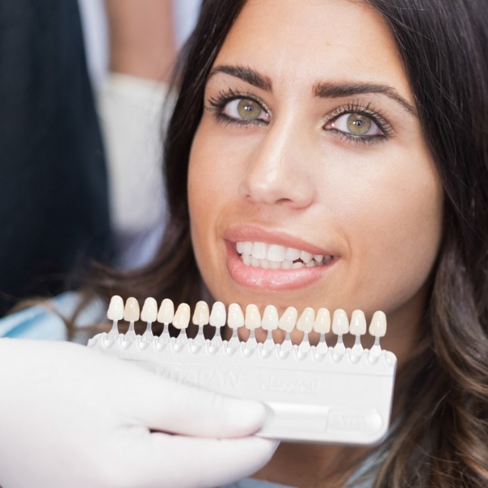 Woman trying on dental veneers from cosmetic dentist
