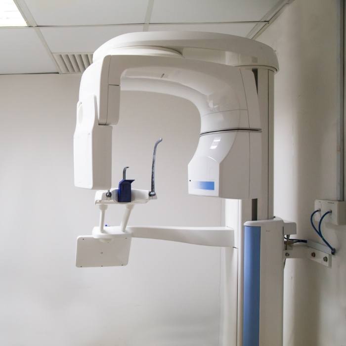 C T cone beam scanner in dental office