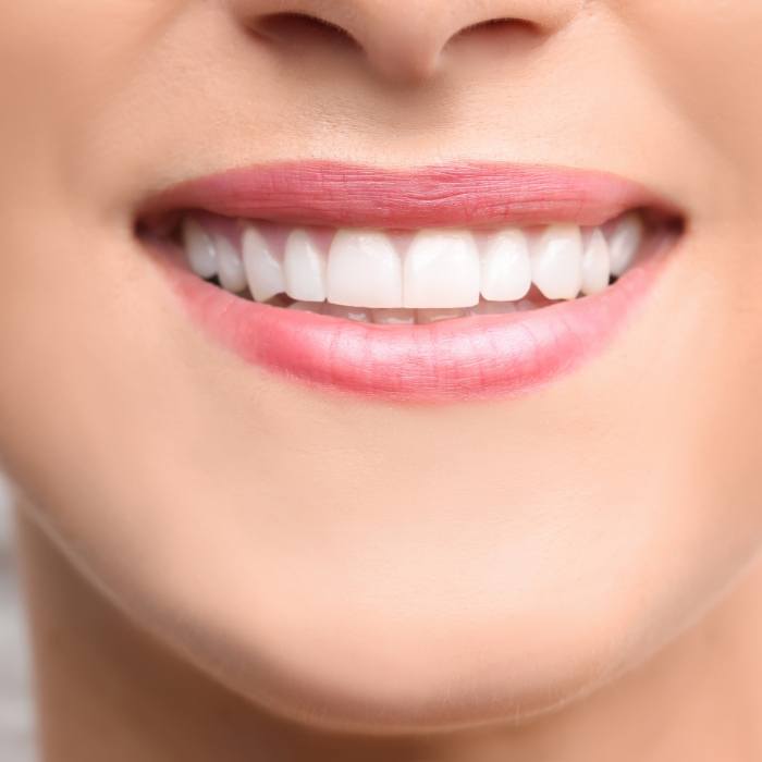 Close up of a smile with straight white teeth